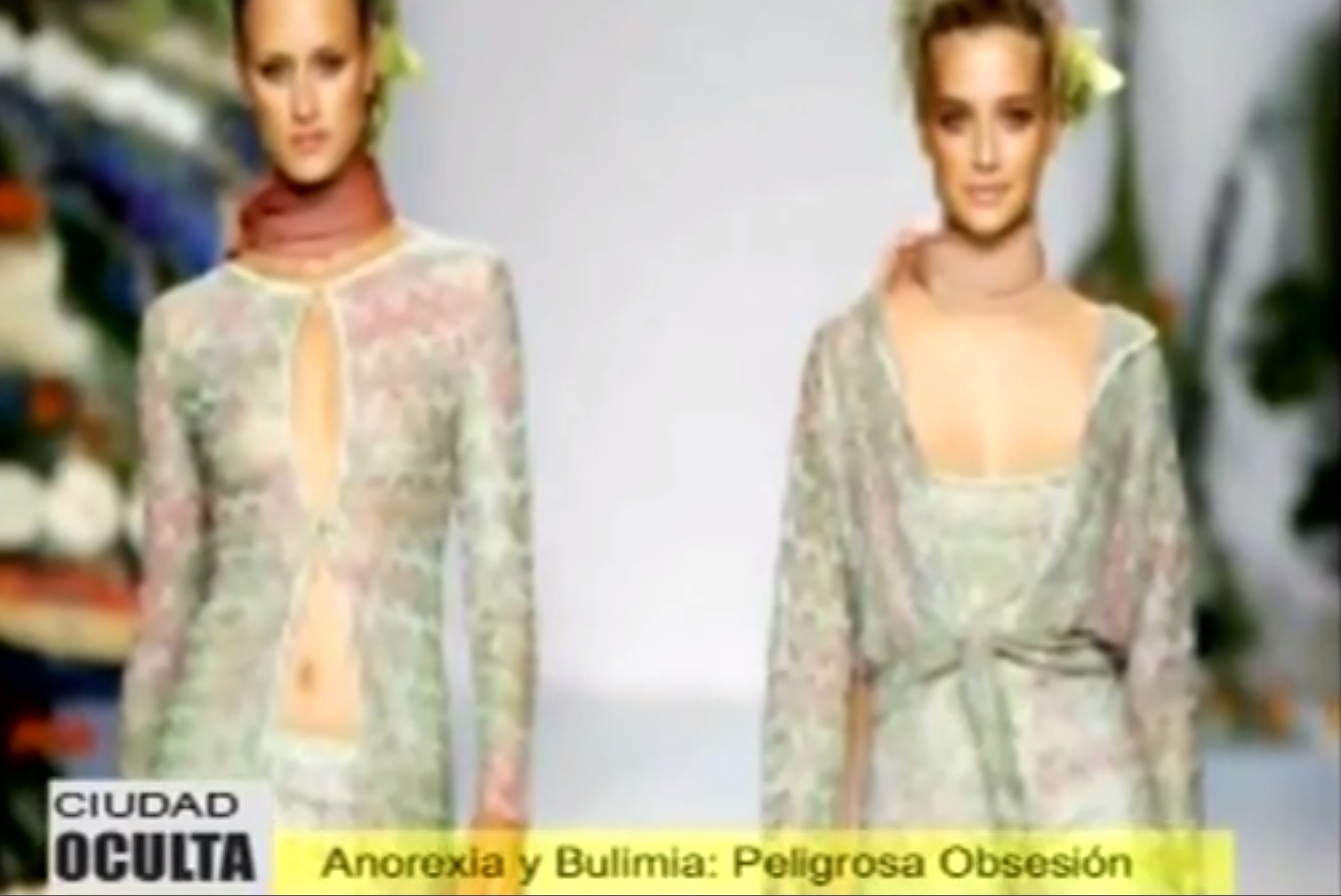 anorexia020614